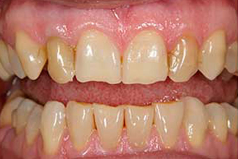 ba 2 before