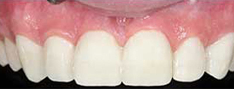 ba 5 after