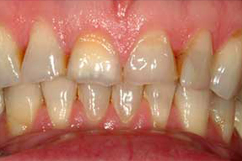 case 5 before