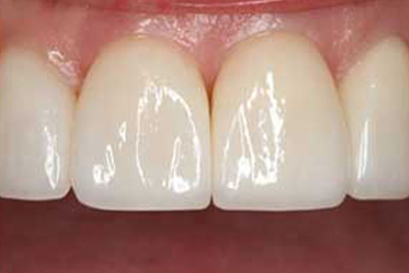 case 6 after