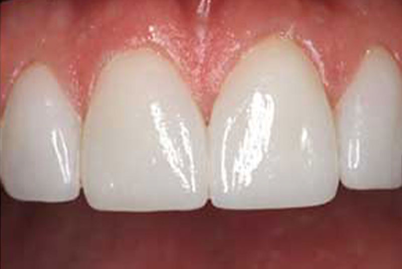 case 8 after