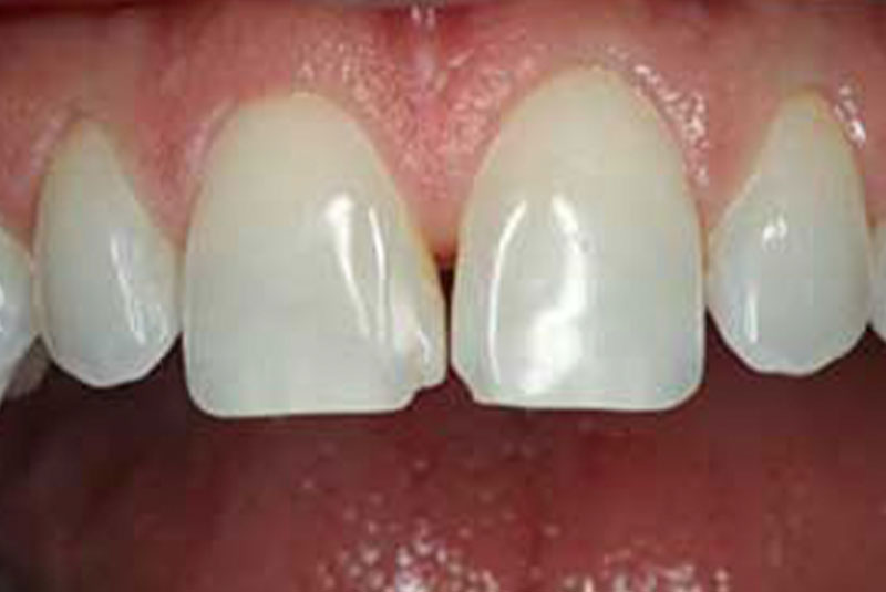 case 8 before