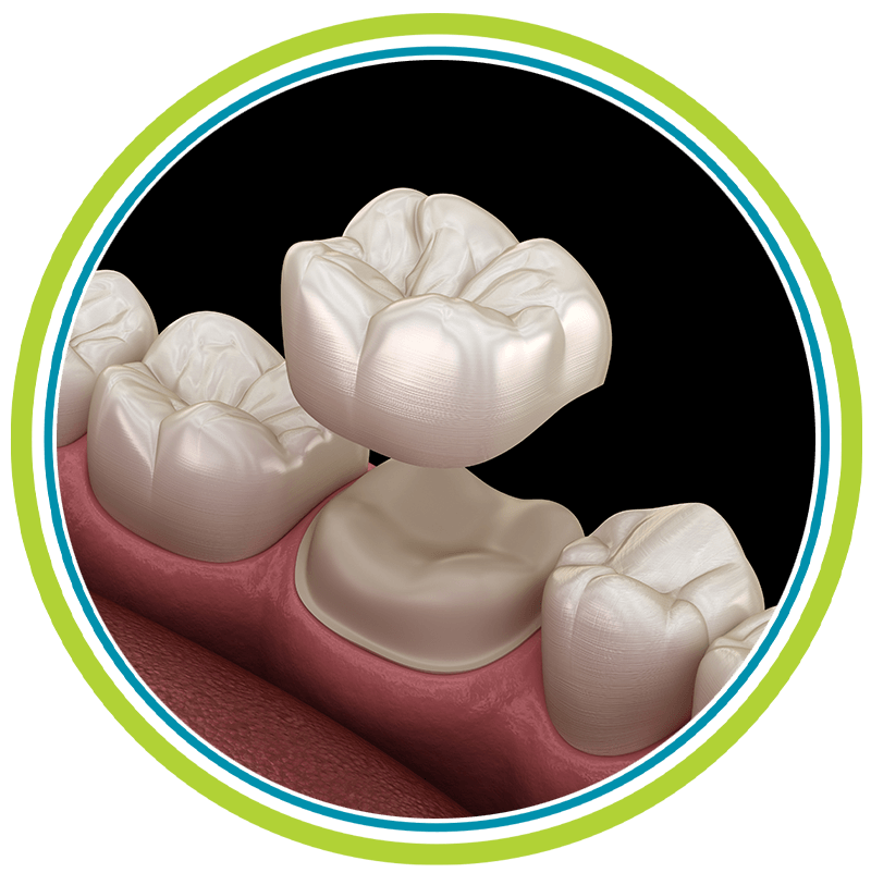 dental crown blk cir