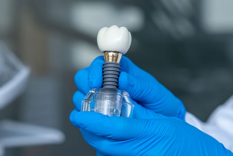dental implant model real flip