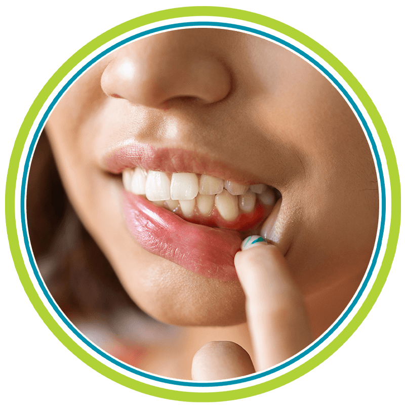 gum issues cir